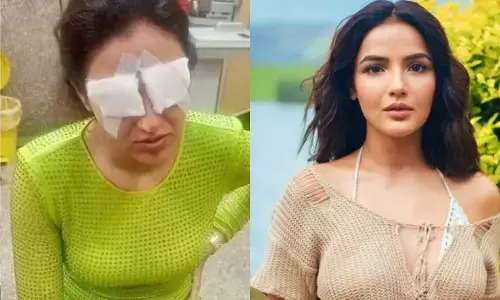 ਅੱਖਾਂ ਚ ਲੈਂਸ ਪਾਉਣ ਤੋਂ ਬਾਅਦ Jasmin Bhasin ਦਾ ਹੋਇਆ ਕੋਰਨੀਆ ਡੈਮੇਜ, ਜਾਣੋ ਪੂਰੀ ਖਬਰ