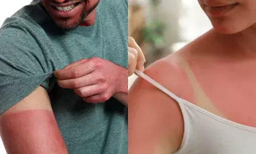 ਹੁਣ ਟੈਨਿੰਗ ਤੋਂ ਘਬਰਾਉਣ ਦੀ ਨਹੀਂ ਹੈ ਜ਼ਰੂਰਤ, ਅਪਣਾਓ ਇਹ ਗੱਲਾਂ