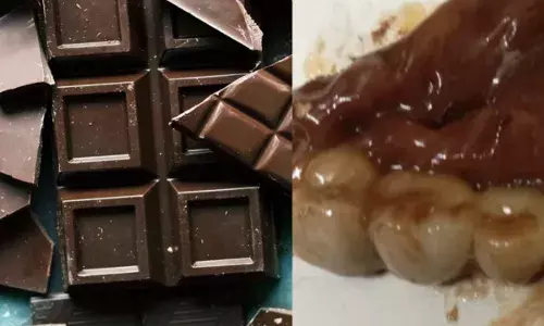 ਚਾਕਲੇਟ ਚੋਂ ਨਿੱਕਲੇ ਦੰਦ ! ਖਬਰ ਸੁਣ ਰਹਿ ਜਾਓਗੇ ਹੈਰਾਨ