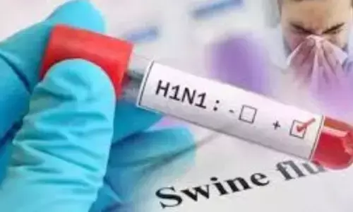 Chandigarh Swine Flu : ਚੰਡੀਗੜ੍ਹ ਤੋਂ ਵੱਡੀ ਖਬਰ, ਸਵਾਈਨ ਫਲੂ ਦਾ ਪਹਿਲਾ ਮਾਮਲਾ ਆਇਆ ਸਾਹਮਣੇ