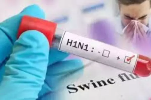 Chandigarh Swine Flu : ਚੰਡੀਗੜ੍ਹ ਤੋਂ ਵੱਡੀ ਖਬਰ, ਸਵਾਈਨ ਫਲੂ ਦਾ ਪਹਿਲਾ ਮਾਮਲਾ ਆਇਆ ਸਾਹਮਣੇ