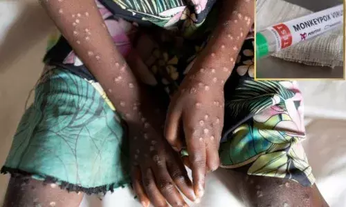 ਹੁਣ ਨਵੀਂ ਬਿਮਾਰੀ ਨੇ ਘੇਰੀ ਦੁਨੀਆ, ਕਰੋਨਾ ਵਾਂਗ ਫੈਲਾਈ ਦਹਿਸ਼ਤ