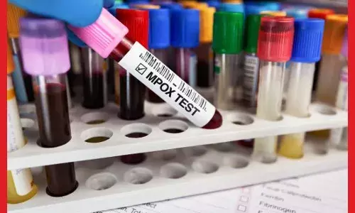 ਪਾਕਿਸਤਾਨ ਚ ਮਿਲਿਆ MPox Virus ਦਾ ਪੰਜਵਾਂ ਮਾਮਲਾ