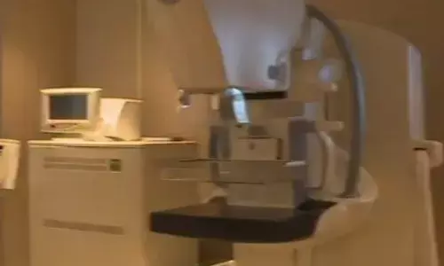 ਉਨਟਾਰੀਓ ਵਿਚ ਮੈਮੋਗ੍ਰਾਮ ਟੈਸਟ ਲਈ ਉਮਰ ਹੱਦ 10 ਸਾਲ ਘਟਾਈ