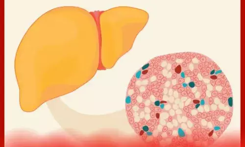 ਫੈਟੀ ਲਿਵਰ ਹੈ ਤਾਂ ਇਸ ਤਰ੍ਹਾਂ ਪਛਾਣੋ