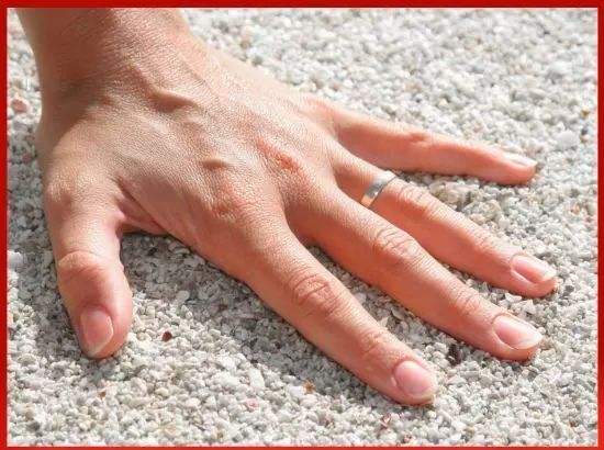 ਮੋਬਾਈਲ ਫੋਨ ਕਾਰਨ ਹੋ ਸਕਣ ਵਾਲੀ ਬਿਮਾਰੀ ਬਾਰੇ ਜਾਣੋ ਮੋਬਾਈਲ ਫੋਨ ਕਾਰਨ ਹੋ ਸਕਣ ਵਾਲੀ ਬਿਮਾਰੀ ਬਾਰੇ ਜਾਣੋ