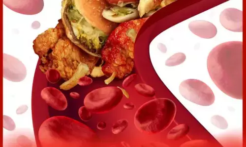 ਸਰੀਰ ਵਿੱਚ ਕੋਲੈਸਟ੍ਰੋਲ ਵਧਣ ਤੇ ਇਹ ਲੱਛਣ ਦਿਸਦੇ ਹਨ