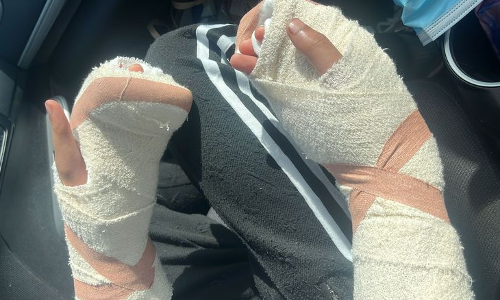 ਆਸਟ੍ਰੇਲੀਆ: ਅੰਤਰਰਾਸ਼ਟਰੀ ਵਿਿਦਆਰਥੀ ਤੇ ਹਮਲਾ, ਕੱਟੀਆਂ ਉਂਗਲਾਂ, ਮਾਰੇ ਚਾਕੂ