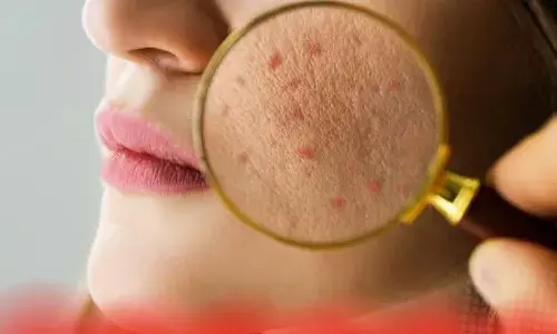 ਆਪਣੀ ਚਮੜੀ ਅਤੇ ਸਰੀਰ ਨੂੰ ਤੰਦਰੁਸਤ ਬਣਾਓ