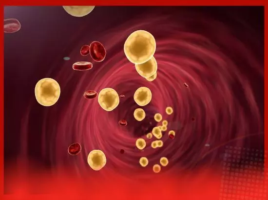 ਬਿਨਾਂ ਦਵਾਈ ਲਏ ਘੱਟ ਕਰੋ ਕੋਲੈਸਟ੍ਰੋਲ ਬਿਨਾਂ ਦਵਾਈ ਲਏ ਘੱਟ ਕਰੋ ਕੋਲੈਸਟ੍ਰੋਲ