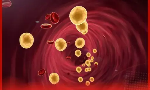 ਬਿਨਾਂ ਦਵਾਈ ਲਏ ਘੱਟ ਕਰੋ ਕੋਲੈਸਟ੍ਰੋਲ