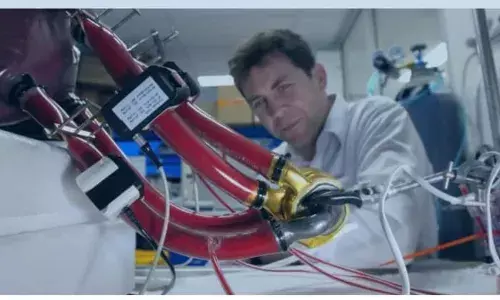 ਨਕਲੀ ਦਿਲ ਨਾਲ ਬਚਾਈ 105 ਦਿਨਾਂ ਤੱਕ ਜਾਨ