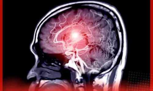 ਇੱਕੋ ਹਸਪਤਾਲ ਦੀਆਂ 10 ਤੋਂ ਵੱਧ ਨਰਸਾਂ ਨੂੰ ਬ੍ਰੇਨ ਹੋਇਆ ਟਿਊਮਰ, ਡਾਕਟਰ ਵੀ ਚਿੰਤਤ