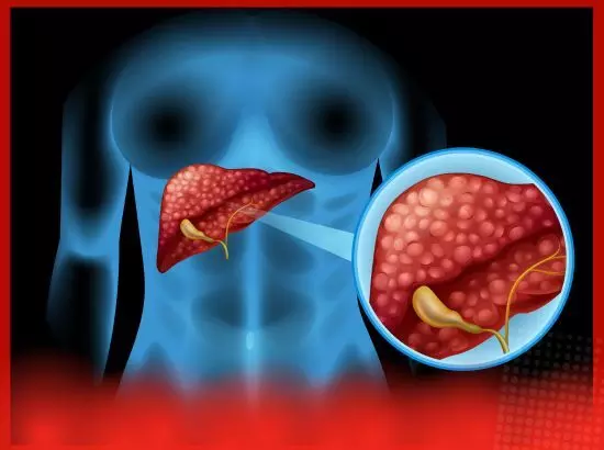 ਬਦਲਦੇ ਮੌਸਮ ਵਿਚ ਜਿਗਰ ਦੀ ਰੱਖਿਆ ਲਈ ਖੁਰਾਕ ਵਿੱਚ ਸ਼ਾਮਲ ਕਰੋ ਇਹ ਭੋਜਨ ਬਦਲਦੇ ਮੌਸਮ ਵਿਚ ਜਿਗਰ ਦੀ ਰੱਖਿਆ ਲਈ ਖੁਰਾਕ ਵਿੱਚ ਸ਼ਾਮਲ ਕਰੋ ਇਹ ਭੋਜਨ