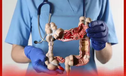 ਵੱਡੀ ਅੰਤੜੀ ਦਾ ਕੈਂਸਰ ਹੋਣ ਤੇ ਦਿਖਾਈ ਦਿੰਦੇ ਹਨ ਇਹ ਲੱਛਣ