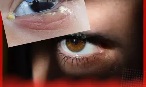 ਅੱਖਾਂ ਵਿੱਚੋਂ ਗਿੱਡ ਜਾਂ ਬਲਗ਼ਮ ਨਿਕਲਣ ਨੂੰ ਨਜ਼ਰਅੰਦਾਜ਼ ਨਾ ਕਰੋ