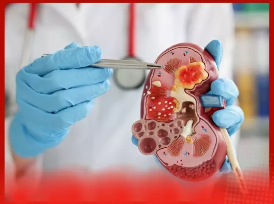 ਗੁਰਦੇ ਦੀ ਪੱਥਰੀ : ਸਰਜਰੀ ਤੋਂ ਬਾਅਦ ਦੁਬਾਰਾ ਪੱਥਰੀ ਕਿਉਂ ਬਣ ਜਾਂਦੀ ਹੈ ?