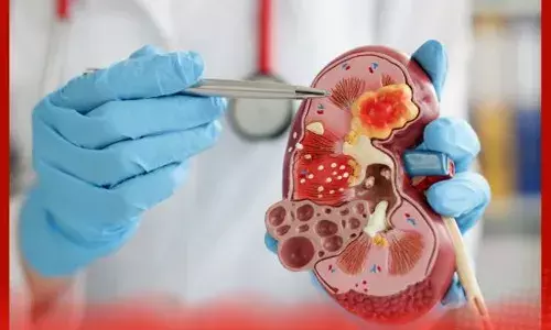 ਗੁਰਦੇ ਦੀ ਪੱਥਰੀ : ਸਰਜਰੀ ਤੋਂ ਬਾਅਦ ਦੁਬਾਰਾ ਪੱਥਰੀ ਕਿਉਂ ਬਣ ਜਾਂਦੀ ਹੈ ?