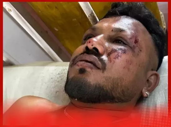 ਅਹਿਮਦਾਬਾਦ ਪਲੇਨ ਕਰੈਸ਼ ਚ ਬਚਿਆ ਇਕਲੌਤਾ ਸ਼ਖ਼ਸ ਕੀ ਆਖਦੈ ?