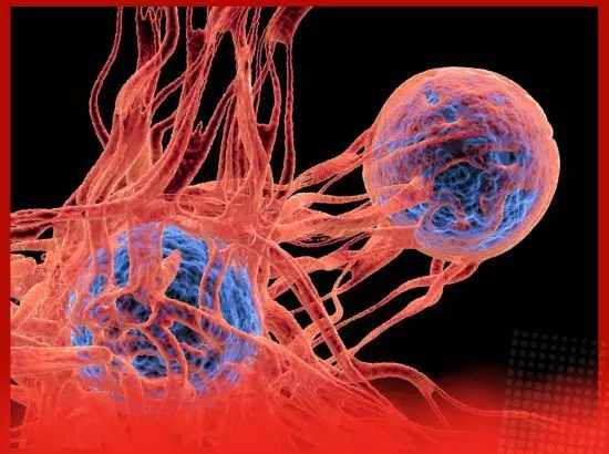 Health : ਮੂੰਹ ਵਿੱਚ ਇਹ ਫੋੜੇ ਬਣ ਸਕਦੇ ਹਨ ਕੈਂਸਰ ਦਾ ਕਾਰਨ