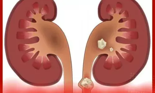 ਗੁਰਦੇ ਦੀ ਪੱਥਰੀ ਬਣਨ ਦੇ ਮੁੱਖ ਕਾਰਨ