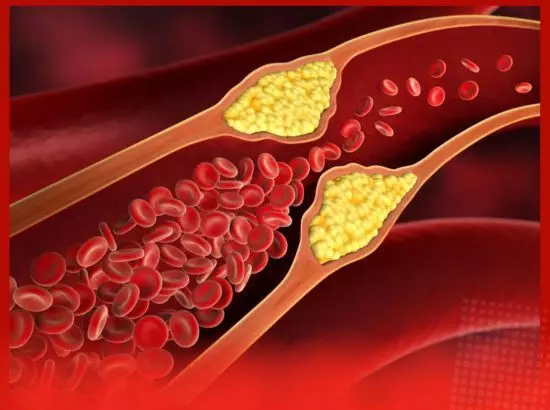 ਕੋਲੈਸਟ੍ਰੋਲ ਤੋਂ ਲੈ ਕੇ ਬੀਪੀ ਤੱਕ, ਇਹ ਚੀਜ਼ ਸਮੱਸਿਆਵਾਂ ਨੂੰ ਦੂਰ ਕਰਨ ਰੱਖੇਗੀ