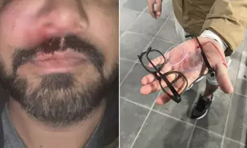 ਡਬਲਿਨ ਵਿਖੇ ਭਾਰਤੀ ਵਿਗਿਆਨੀ ਬੁਰੀ ਤਰ੍ਹਾਂ ਕੁੱਟਿਆ