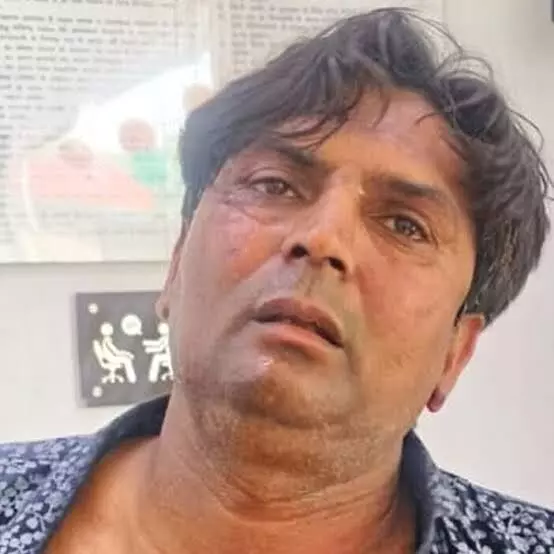 Rekha Gupta: ਰੇਖਾ ਗੁਪਤਾ ਨੂੰ ਥੱਪੜ ਮਾਰਨ ਵਾਲੇ ਦੀ ਮਾਂ ਦਾ ਬਿਆਨ, ਕਿਹਾ- ਮੇਰਾ ਬੇਟਾ ਪਸ਼ੂ ਪ੍ਰੇਮੀ ਹੈ, ਨਾ ਕਿ ਕਿਸੇ ਸਿਆਸੀ ਪਾਰਟੀ ਦਾ ਮੈਂਬਰ