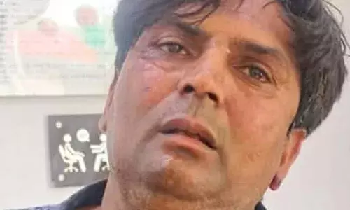 Rekha Gupta: ਰੇਖਾ ਗੁਪਤਾ ਨੂੰ ਥੱਪੜ ਮਾਰਨ ਵਾਲੇ ਦੀ ਮਾਂ ਦਾ ਬਿਆਨ, ਕਿਹਾ- ਮੇਰਾ ਬੇਟਾ ਪਸ਼ੂ ਪ੍ਰੇਮੀ ਹੈ, ਨਾ ਕਿ ਕਿਸੇ ਸਿਆਸੀ ਪਾਰਟੀ ਦਾ ਮੈਂਬਰ