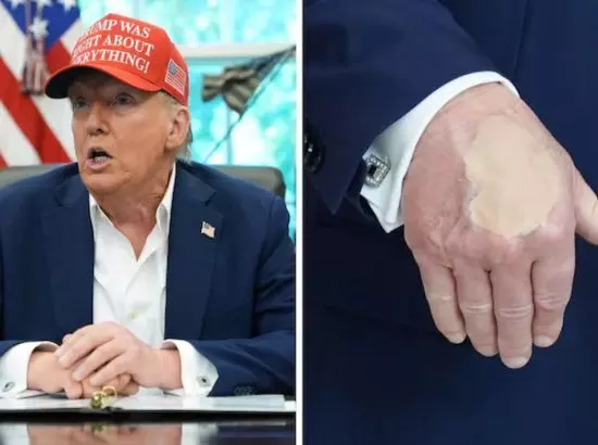 ਕੀ ਹੋਇਆ, ਅਮਰੀਕੀ ਰਾਸ਼ਟਰਪਤੀ ਕਿਹੜੀ ਬਿਮਾਰੀ ਲੁਕਾ ਰਹੇ ? ਕੀ ਹੋਇਆ, ਅਮਰੀਕੀ ਰਾਸ਼ਟਰਪਤੀ ਕਿਹੜੀ ਬਿਮਾਰੀ ਲੁਕਾ ਰਹੇ ?