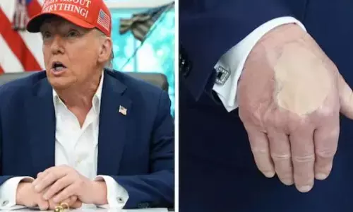 ਕੀ ਹੋਇਆ, ਅਮਰੀਕੀ ਰਾਸ਼ਟਰਪਤੀ ਕਿਹੜੀ ਬਿਮਾਰੀ ਲੁਕਾ ਰਹੇ ?