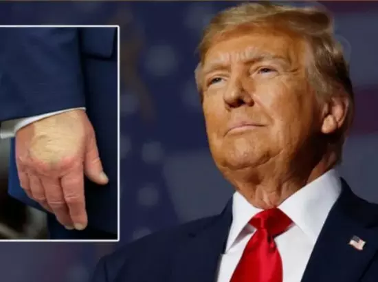 ਡੋਨਾਲਡ ਟਰੰਪ ਦੀ ਸਿਹਤ ਤੇ ਵੱਡਾ ਦਾਅਵਾ: ਵ੍ਹਾਈਟ ਹਾਊਸ ਨੇ ਦਿੱਤੀ ਜਾਣਕਾਰੀ