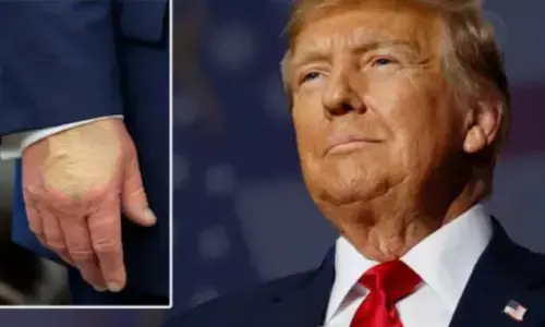 ਡੋਨਾਲਡ ਟਰੰਪ ਦੀ ਸਿਹਤ ਤੇ ਵੱਡਾ ਦਾਅਵਾ: ਵ੍ਹਾਈਟ ਹਾਊਸ ਨੇ ਦਿੱਤੀ ਜਾਣਕਾਰੀ