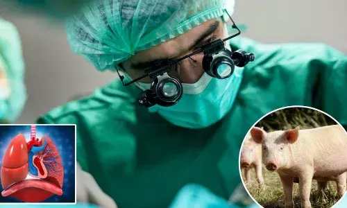 ਸੂਰ ਦੇ ਫੇਫੜਿਆਂ ਨਾਲ ਸਾਹ ਲੈ ਸਕੇਗਾ ਇਨਸਾਨ? ਵਿਗਿਆਨੀਆਂ ਨੇ ਕਰਤਾ ਵੱਡਾ ਕਮਾਲ