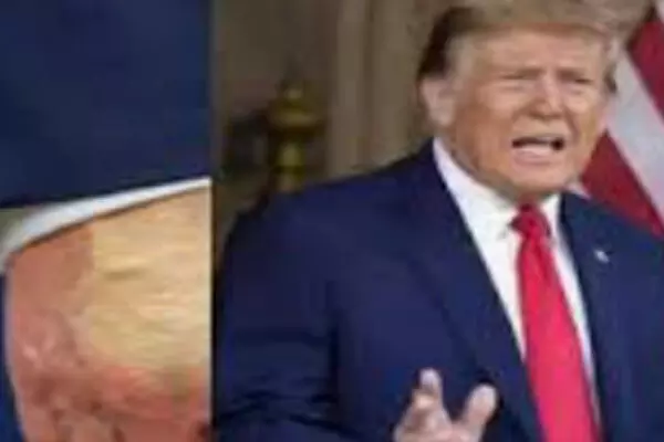 ਟਰੰਪ ਦੇ ਅਕਾਲ ਚਲਾਣੇ ਦੀਆਂ ਅਫ਼ਵਾਹਾਂ ਨੇ ਪਾਇਆ ਭੜਥੂ