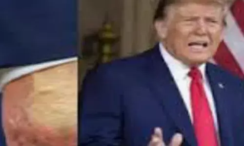 ਟਰੰਪ ਦੇ ਅਕਾਲ ਚਲਾਣੇ ਦੀਆਂ ਅਫ਼ਵਾਹਾਂ ਨੇ ਪਾਇਆ ਭੜਥੂ