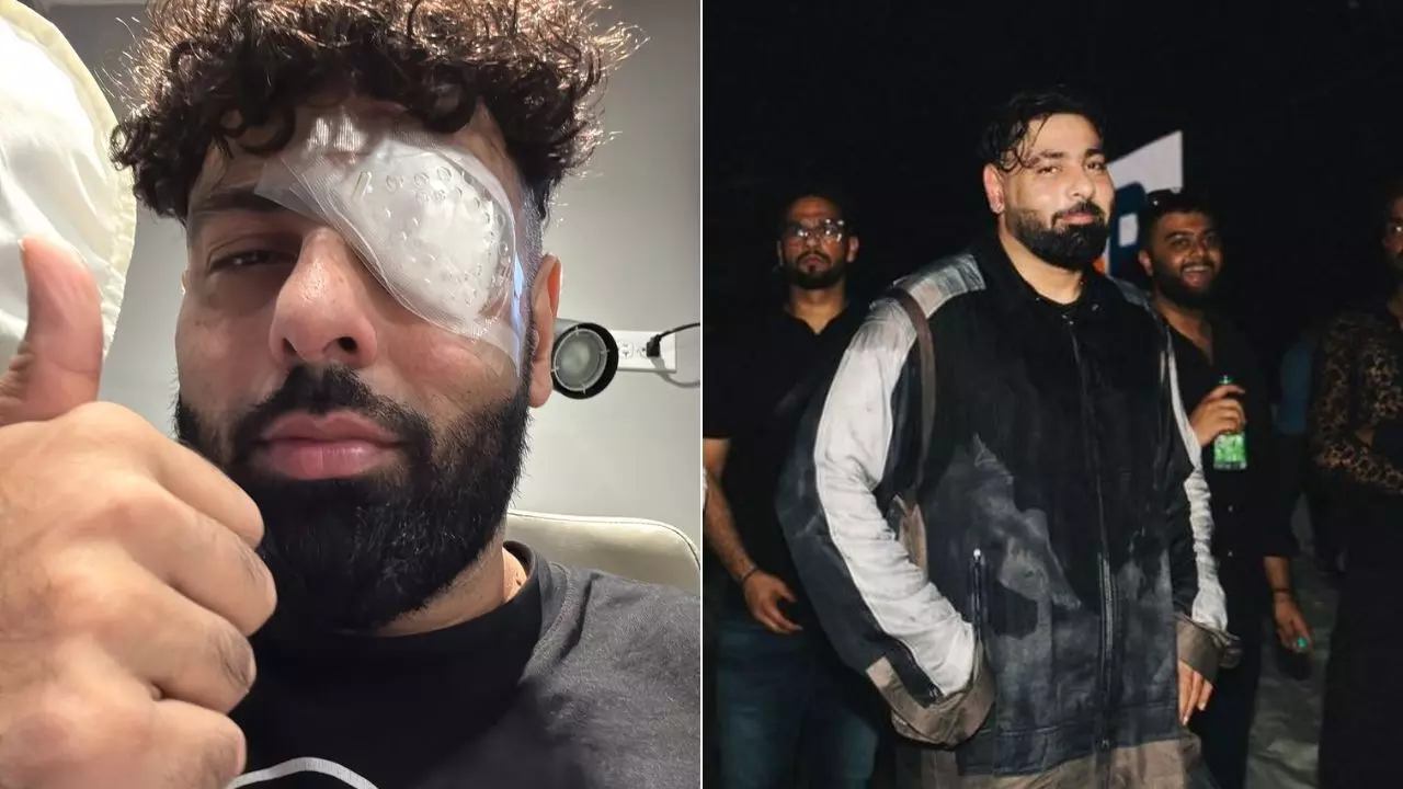 Badshah: ਜ਼ਖ਼ਮੀ ਹੋਇਆ ਰੈਪਰ ਬਾਦਸ਼ਾਹ? ਖ਼ੁਦ ਸ਼ੇਅਰ ਕੀਤੀ ਤਸਵੀਰ, ਅੱਖ ਤੇ ਪੱਟੀ ਬੰਨੀ ਆਇਆ ਨਜ਼ਰ