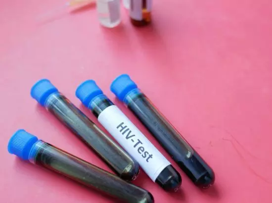 ਭਾਰਤ ਦੇ ਇਸ ਹਸਪਤਾਲ ਵਿਚ 5 ਬੱਚਿਆਂ ਨੂੰ ਚੜ੍ਹਿਆ HIV ਸੰਕਰਮਿਤ ਖੂਨ