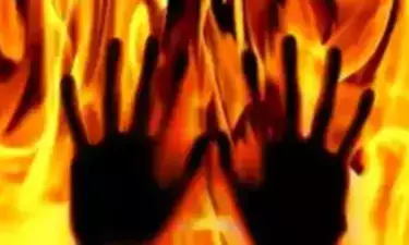 Crime News: ਨਾਬਾਲਗ ਨੇ 17 ਸਾਲਾ ਕੁੜੀ ਨੂੰ ਜ਼ਿੰਦਾ ਸਾੜਿਆ, ਪਿਆਰ ਦਾ ਚੱਕਰ