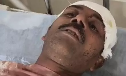 ਅੰਮ੍ਰਿਤਸਰ ਥਾਣਾ ਸੀ ਡਵੀਜਨ ਇਲਾਕੇ ਦੀ ਇੱਕ ਗਲੀ ਵਿੱਚ ਹੋਈ ਭਿਆਨਕ ਹਿੰਸਾ, ਇੱਕ ਵਿਅਕਤੀ ਦੀ ਬੁਰੀ ਤਰੀਕੇ ਨਾਲ ਕੁੱਟਮਾਰ, ਵੀਡੀਓ ਸੋਸ਼ਲ ਮੀਡੀਆ ਤੇ ਵਾਇਰਲ