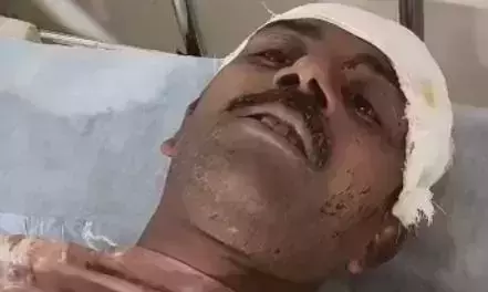 ਅੰਮ੍ਰਿਤਸਰ ਥਾਣਾ ਸੀ ਡਵੀਜਨ ਇਲਾਕੇ ਦੀ ਇੱਕ ਗਲੀ ਵਿੱਚ ਹੋਈ ਭਿਆਨਕ ਹਿੰਸਾ, ਇੱਕ ਵਿਅਕਤੀ ਦੀ ਬੁਰੀ ਤਰੀਕੇ ਨਾਲ ਕੁੱਟਮਾਰ, ਵੀਡੀਓ ਸੋਸ਼ਲ ਮੀਡੀਆ ਤੇ ਵਾਇਰਲ