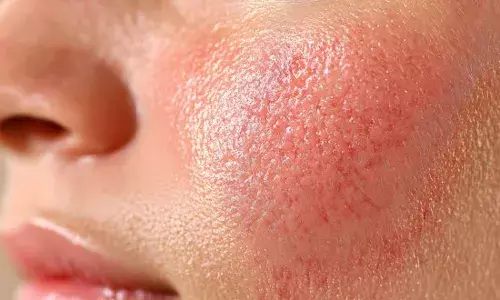 ਚਮੜੀ ਦੇ ਰੋਗਾਂ ਦੇ ਕਾਰਨ ਅਤੇ ਰੋਕਥਾਮ