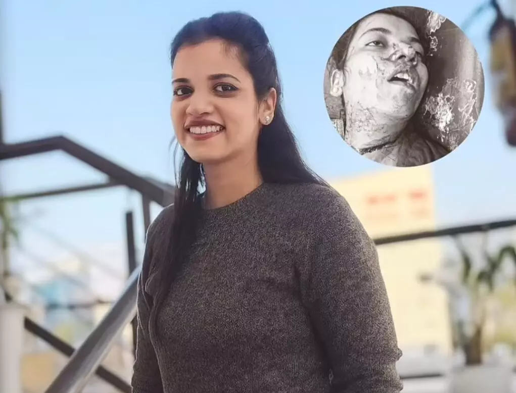 Chandigarh: ਚੰਡੀਗੜ੍ਹ ਦੇ ਰੋਜ਼ ਗਾਰਡਨ ਵਿੱਚ ਮਿਲੀ ਔਰਤ ਦੀ ਖ਼ੂਨ ਨਾਲ ਲਥਪਥ ਲਾਸ਼, ਇਲਾਕੇ ਵਿੱਚ ਦਹਿਸ਼ਤ ਦਾ ਮਾਹੌਲ Chandigarh: ਚੰਡੀਗੜ੍ਹ ਦੇ ਰੋਜ਼ ਗਾਰਡਨ ਵਿੱਚ ਮਿਲੀ ਔਰਤ ਦੀ ਖ਼ੂਨ ਨਾਲ ਲਥਪਥ ਲਾਸ਼, ਇਲਾਕੇ ਵਿੱਚ ਦਹਿਸ਼ਤ ਦਾ ਮਾਹੌਲ