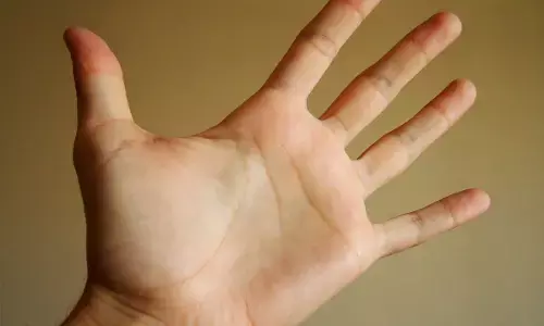 Palmistry: ਹਥੇਲੀ ਵਿੱਚ ਇਹ ਲਾਈਨ ਹੈ ਤਾਂ ਤੁਹਾਡੇ ਕੋਲ ਹੋਵੇਗੀ ਬੇਸ਼ੁਮਾਰ ਦੌਲਤ, ਦੁਨੀਆ ਵਿੱਚ ਹੋਵੇਗਾ ਨਾਮ Palmistry: ਹਥੇਲੀ ਵਿੱਚ ਇਹ ਲਾਈਨ ਹੈ ਤਾਂ ਤੁਹਾਡੇ ਕੋਲ ਹੋਵੇਗੀ ਬੇਸ਼ੁਮਾਰ ਦੌਲਤ, ਦੁਨੀਆ ਵਿੱਚ ਹੋਵੇਗਾ ਨਾਮ