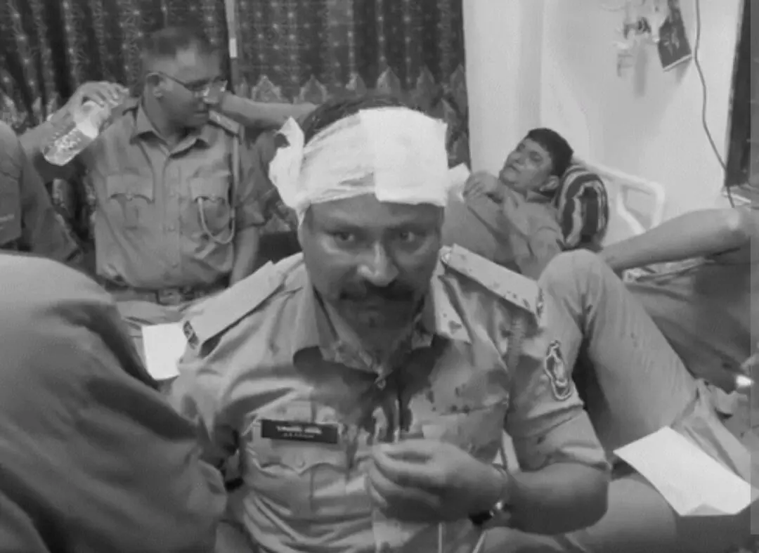 Crime News: ਜੰਗਲ ਦੀ ਜ਼ਮੀਨ ਨੂੰ ਲੈਕੇ ਹੰਗਾਮਾ, ਪੁਲਿਸ ਇੰਸਪੈਕਟਰ ਨੂੰ ਮਾਰੇ ਤੀਰ, ਹੋਇਆ ਜ਼ਖ਼ਮੀ Crime News: ਜੰਗਲ ਦੀ ਜ਼ਮੀਨ ਨੂੰ ਲੈਕੇ ਹੰਗਾਮਾ, ਪੁਲਿਸ ਇੰਸਪੈਕਟਰ ਨੂੰ ਮਾਰੇ ਤੀਰ, ਹੋਇਆ ਜ਼ਖ਼ਮੀ