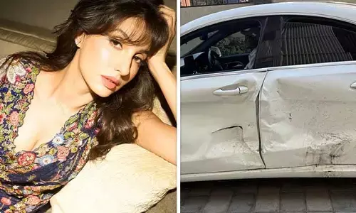 Nora Fatehi: ਅਦਾਕਾਰਾ ਨੋਰਾ ਫਤੇਹੀ ਦਾ ਹੋਇਆ ਐਕਸੀਡੈਂਟ, ਸਿਰ ਵਿੱਚ ਲੱਗੀ ਡੂੰਘੀ ਸੱਟ