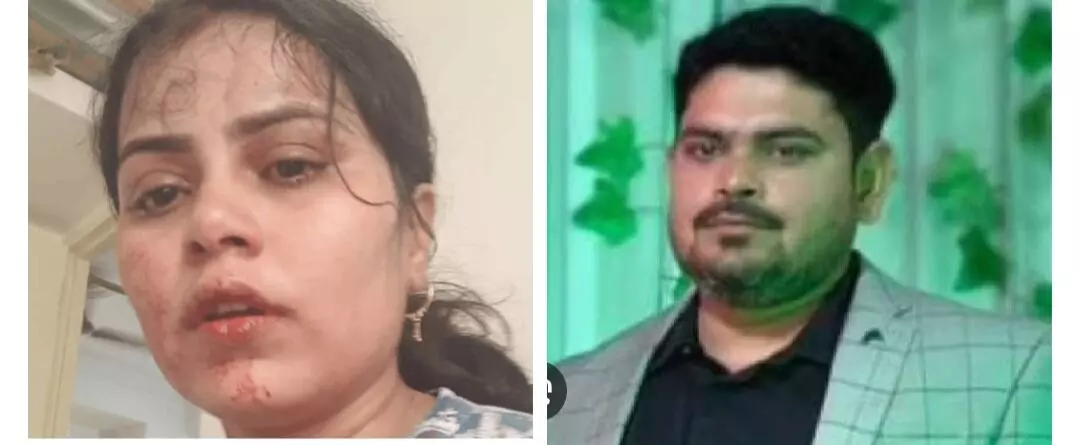 Crime News: ਬੈਂਕ ਤੋਂ ਕਰਜ਼ਾ ਮੁਆਫ਼ ਕਰਾਉਣ ਲਈ ਪਤਨੀ ਨੂੰ ਪਿਲਾ ਦਿੱਤੀ ਫ਼ਰਨੈਲ, ਹਾਲਤ ਨਾਜ਼ੁਕ Crime News: ਬੈਂਕ ਤੋਂ ਕਰਜ਼ਾ ਮੁਆਫ਼ ਕਰਾਉਣ ਲਈ ਪਤਨੀ ਨੂੰ ਪਿਲਾ ਦਿੱਤੀ ਫ਼ਰਨੈਲ, ਹਾਲਤ ਨਾਜ਼ੁਕ