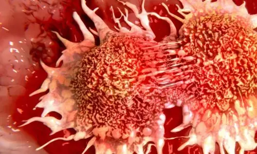 Cervical cancer : ਹਰ 8 ਮਿੰਟਾਂ ਵਿੱਚ ਇੱਕ ਜਾਨ ਲੈਣ ਵਾਲਾ ਸਾਈਲੈਂਟ ਕਿੱਲਰ