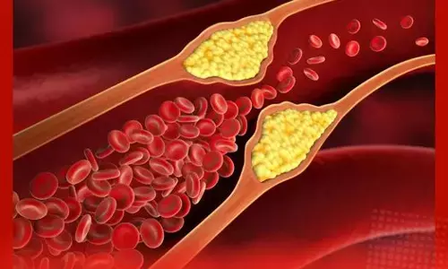 High Cholesterol: ਕੋਲੈਸਟ੍ਰੋਲ ਵਧਣ ਦੇ ਮੁੱਖ ਕਾਰਨ ਅਤੇ ਬਚਾਅ ਦੇ ਤਰੀਕੇ