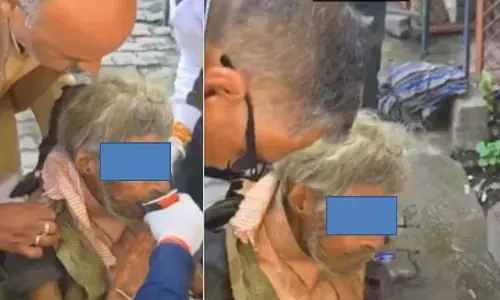 ਤਰਸਯੋਗ ਹਾਲਤ ਵਿੱਚ ਮਿਲ਼ਿਆ ਬਜ਼ੁਰਗ ਡਾਕਟਰ, ਡੇਢ ਸਾਲ ਤੋਂ ਕਦੇ ਕੱਪੜੇ ਵੀ ਨਹੀਂ ਬਦਲੇ